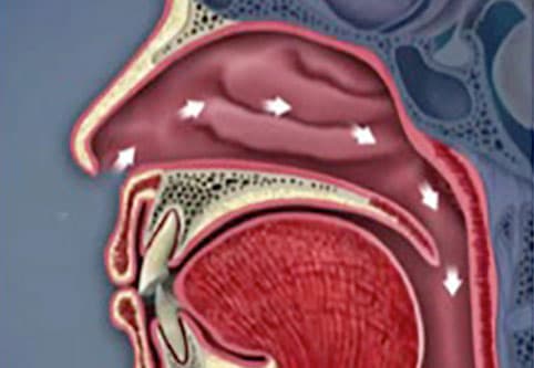 Nasal airway and breathing optimization
